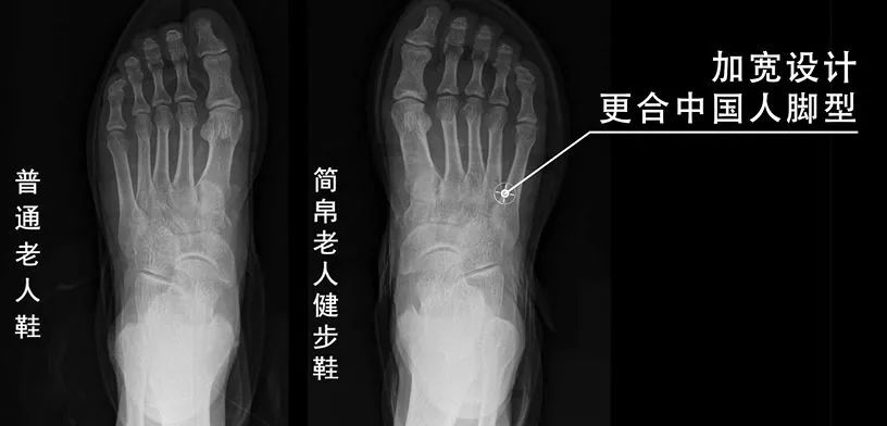 专为父母设计的健步鞋，防滑轻巧、透气时髦，我们自己穿也行！