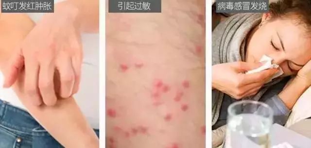 日本驱蚊好物,夏天灭蚊必备好物