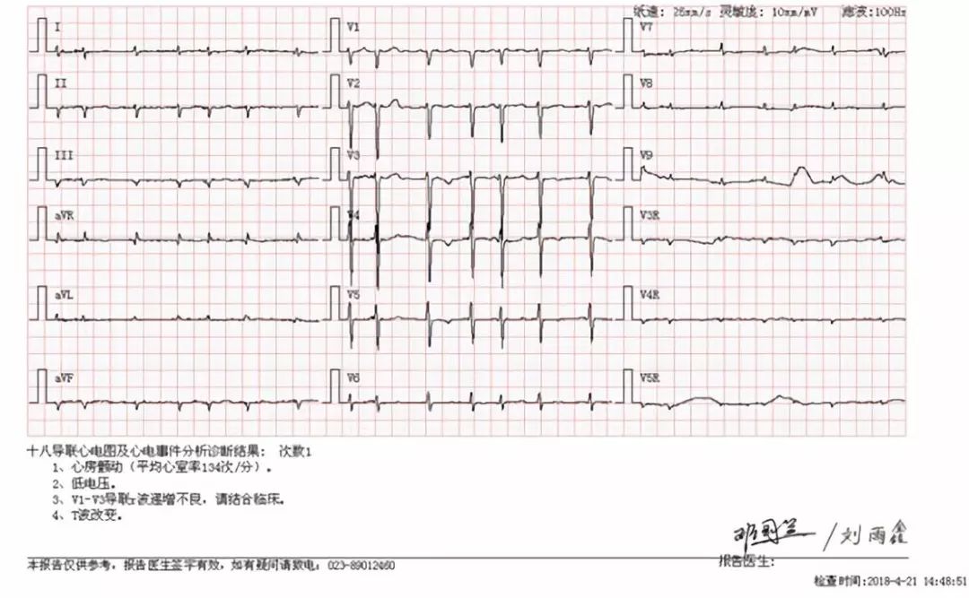 心衰治疗新金三角药物图片,心衰金三角和新三角