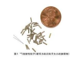 哪些肿瘤患者适合微创介入治疗,晚期癌症能做碘125粒子植入术