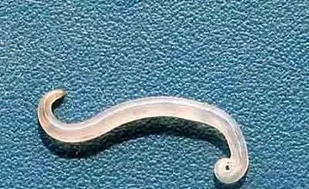 惊！长春高二女生头上洗出数条1厘米长白虫子！这个习惯你有吗？