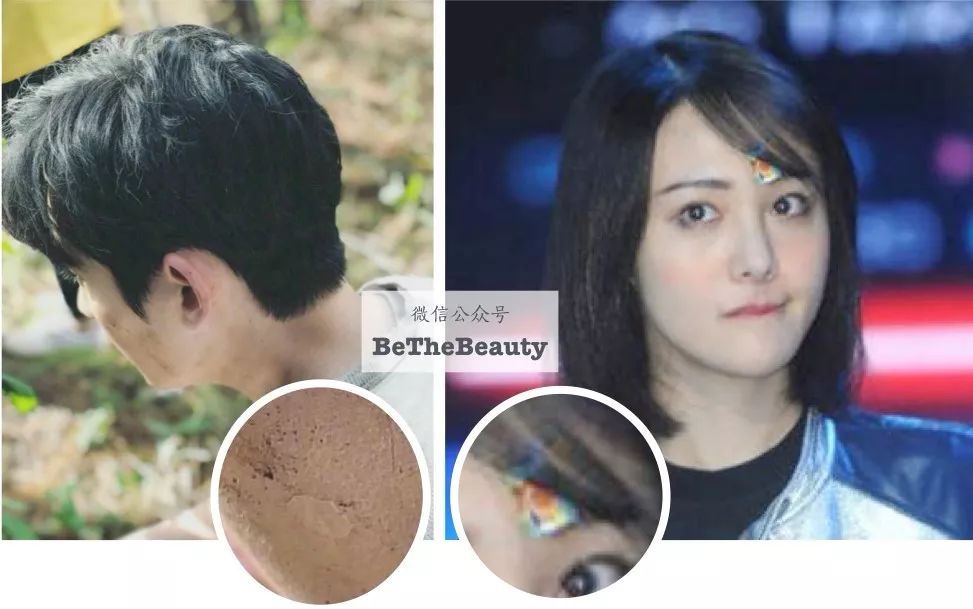 灰头土脸怎么改善,灰头土脸怎么预防