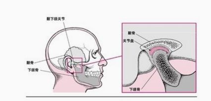 颞下颌关节紊乱病治疗的首选方法,颞下颌关节紊乱综合征怎么治愈
