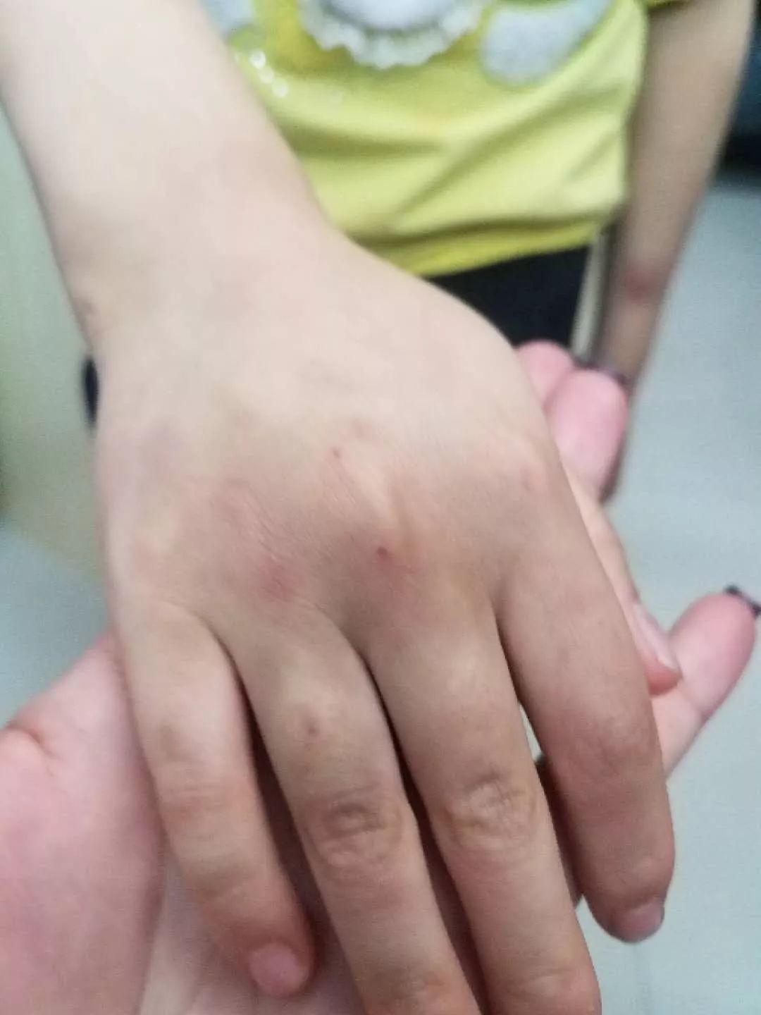 女童遭家暴送医后死亡,河源女婴被爸爸暴打