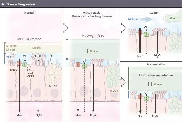 阻塞性肺疾病中医辨证论治,阻塞性疾病怎么治疗