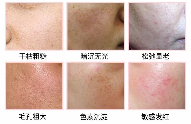 婆孙恋,婆孙恋电视剧