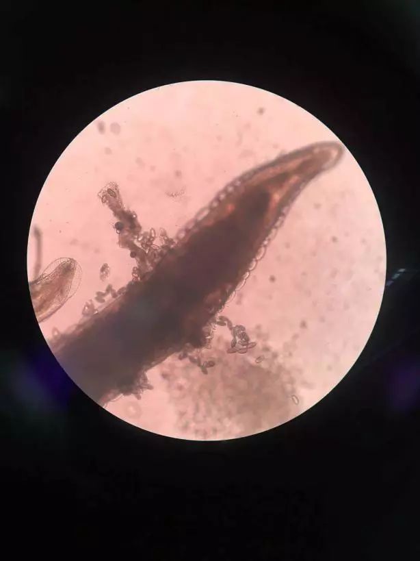 四岁女宝宝说小便地方痒用什么药,四岁女宝宝说小便地方痒怎么治疗