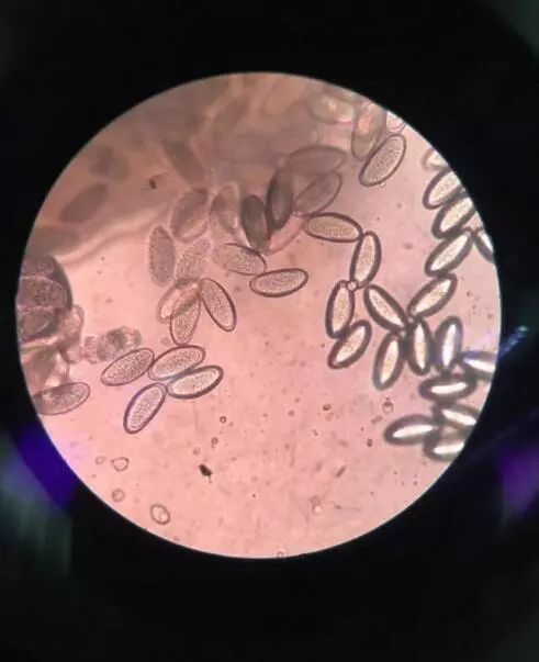 孩子屁股痒怎么办最有效的方法,孩子屁股痒怎么可以止痒