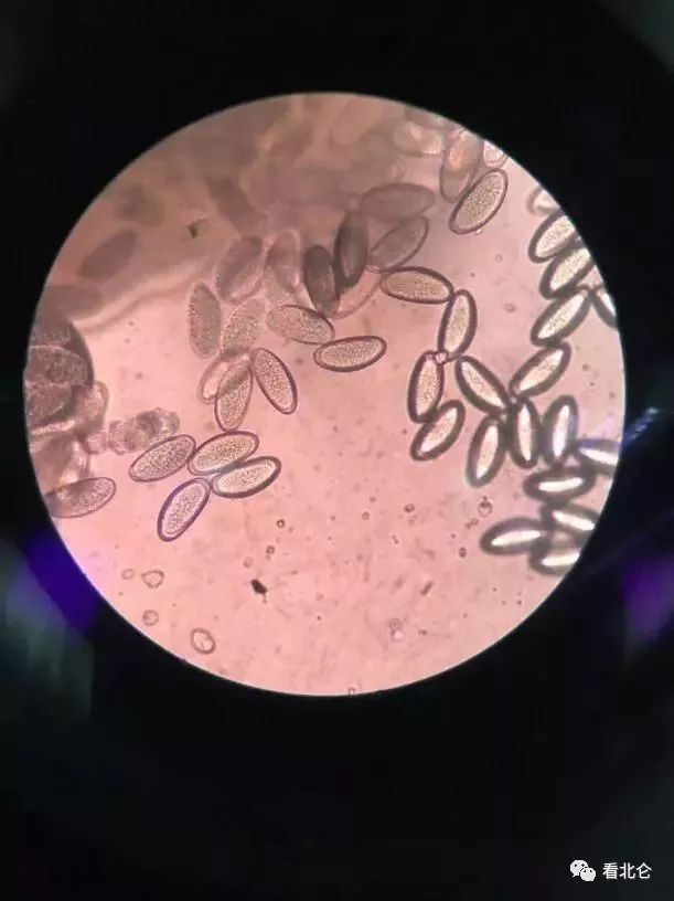 宝宝尿裤穿久屁股痒怎么办,小宝屁股上穿纸尿裤痒怎么办