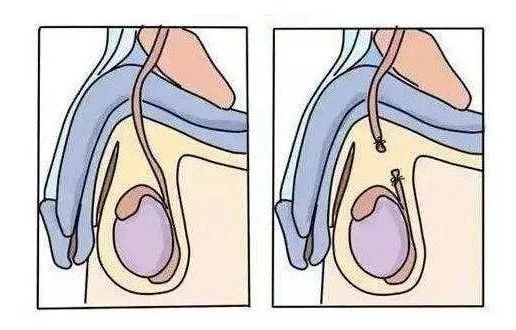 这3种避孕方式并不靠谱,这3种避孕方法其实并不靠谱