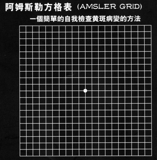 眼底黄斑病变一般多久会失明,眼底黄斑病的养护和关注事项