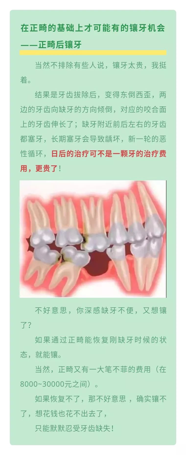 看牙齿最省钱方法,看牙太贵怎么才能健康又实惠