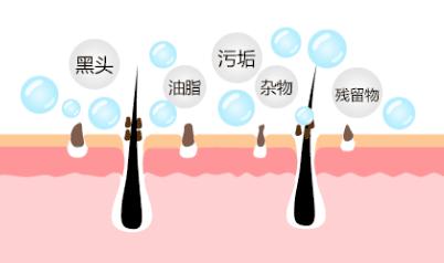 脸上搓下来很多泥,脸上搓出黑头