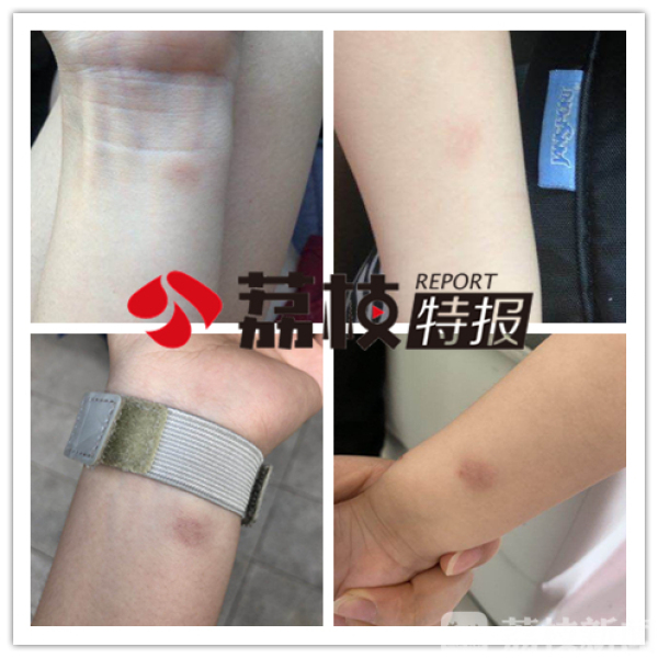 美吉姆早教中心老师查出肺结核,南京早教肺结核