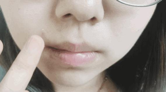 保湿、消炎、止痒、晒后修复，一管芦荟胶全搞定，宝宝也能用