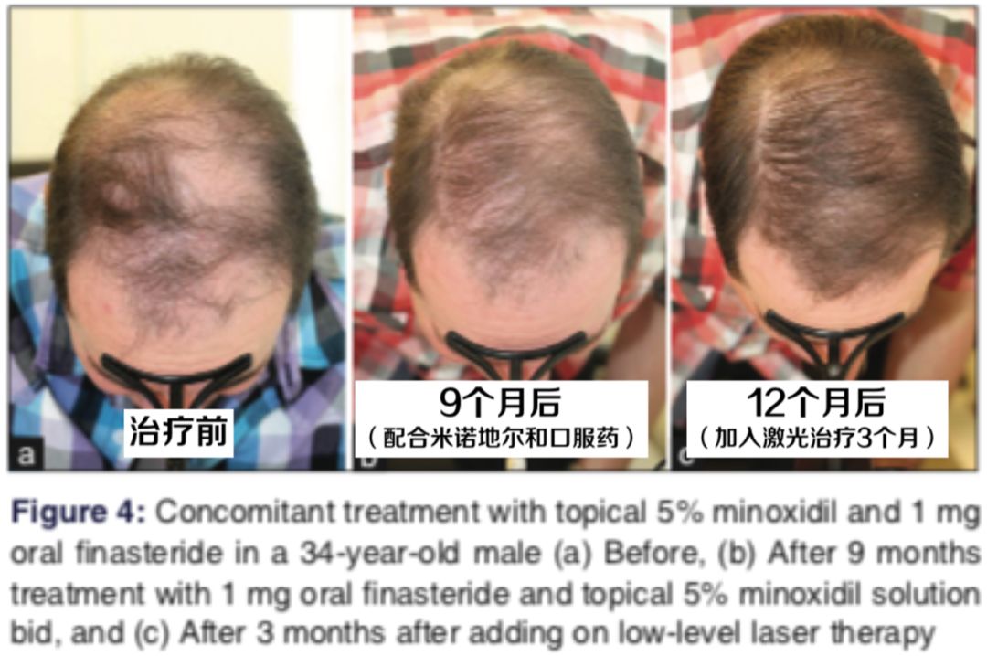 想要「换发型等于换头」？看这简单3步就可以