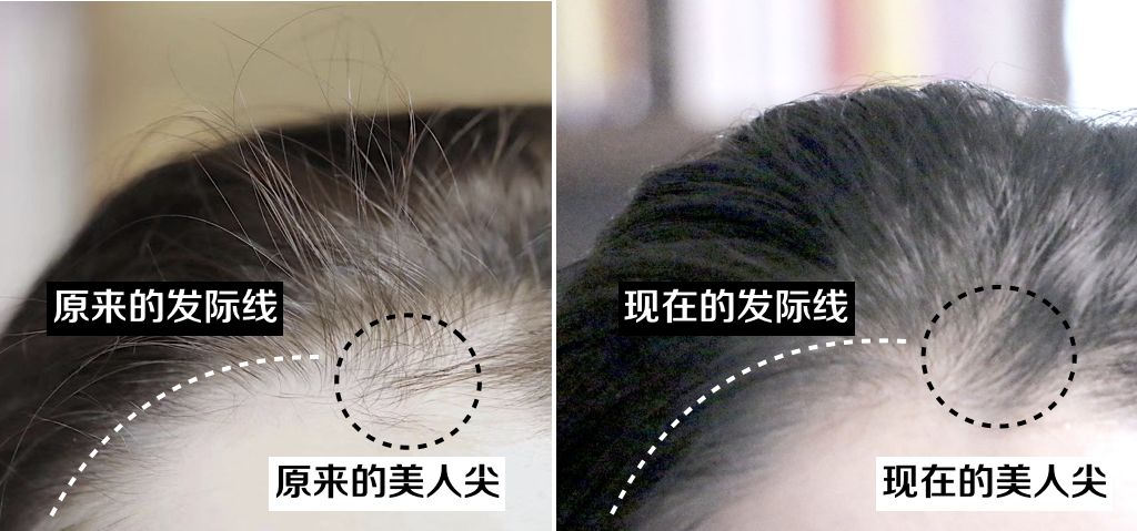 想要「换发型等于换头」？看这简单3步就可以