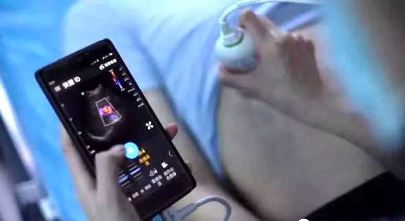 动脉硬化最新检查手段,动脉硬化最佳检查方法