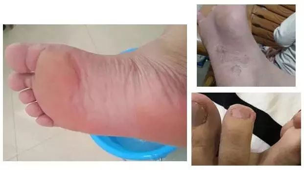 46项专利的汉麻袜，7天不洗也不臭，99.9%高效抑菌，秒速排汗-5℃