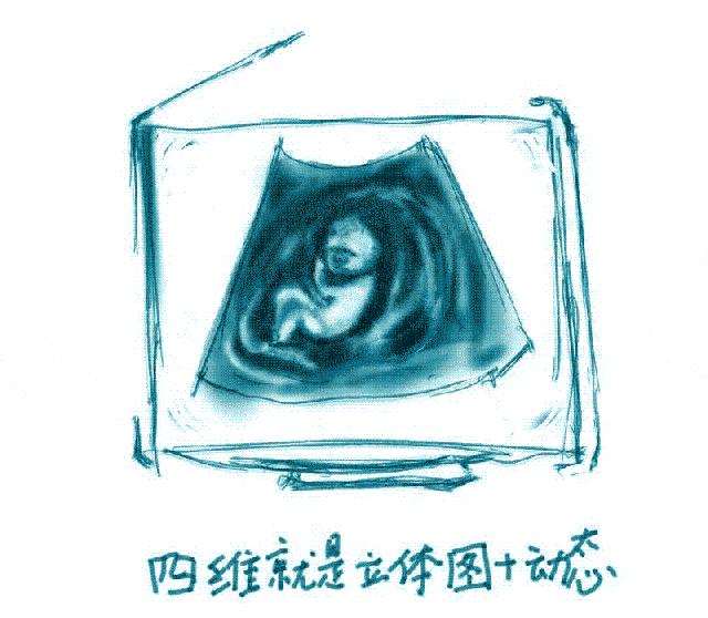 孕妈妈检查必备,孕妈妈b超检查胎儿