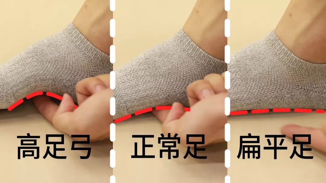 走路掉袜子的科学解决方法,老是掉袜子怎么办小妙招