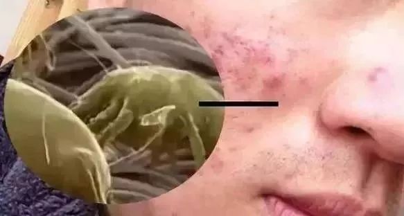 蚕丝被不盖怎么处理,盖蚕丝被的好处还是坏处