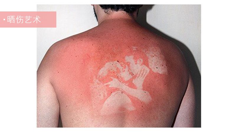 晒后急救小妙招自制面膜,晒后急救处理方法