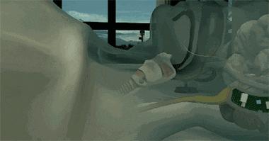 打呼噜也是一种病吗,睡觉打呼噜怎么治民间止鼾妙招