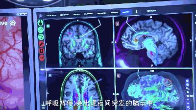 打呼噜也是一种病吗,睡觉打呼噜怎么治民间止鼾妙招