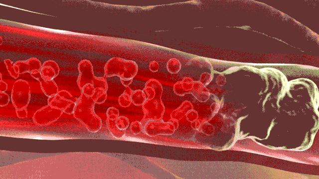 3秒速溶,2秒速溶