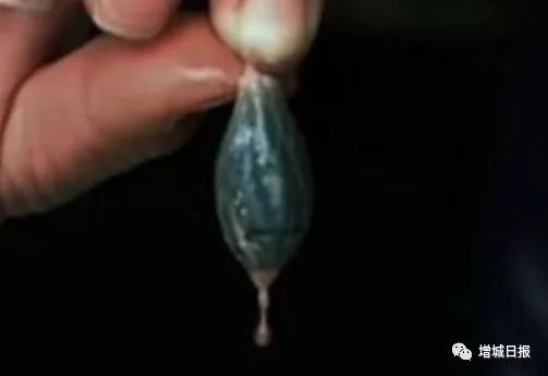 一男子用民间偏方治病险送命！这些偏方都是血淋淋的教训，千万别信