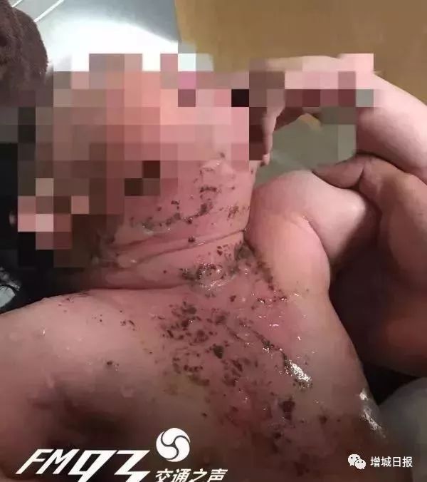 一男子用民间偏方治病险送命！这些偏方都是血淋淋的教训，千万别信