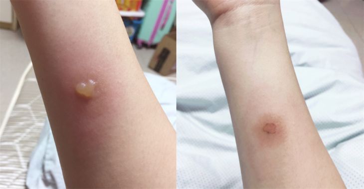 驱蚊止痒神器泰国进口青草膏,泰国防蚊青草膏