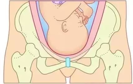 麦澜德产后盆底肌康复有用吗,产后盆底肌康复瑜伽每天做几次