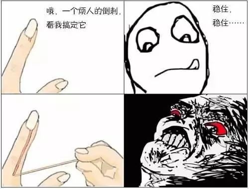 血泪教训的十个方法,手上长倒刺别乱撕这样做更靠谱