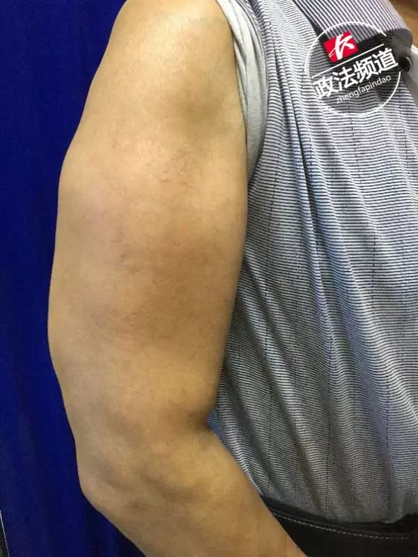 医院门诊来了两位“绿巨人”，他们都爱喝这个…