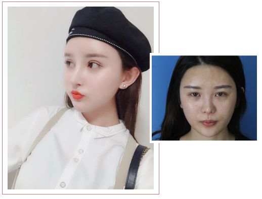 大事件！诺德「校园天使」全城征集！颜值and才艺双双爆表