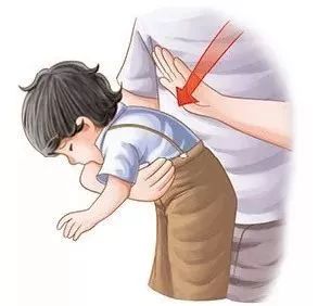 气管卡住异物急救法叫什么,气管异物急救法3-8岁