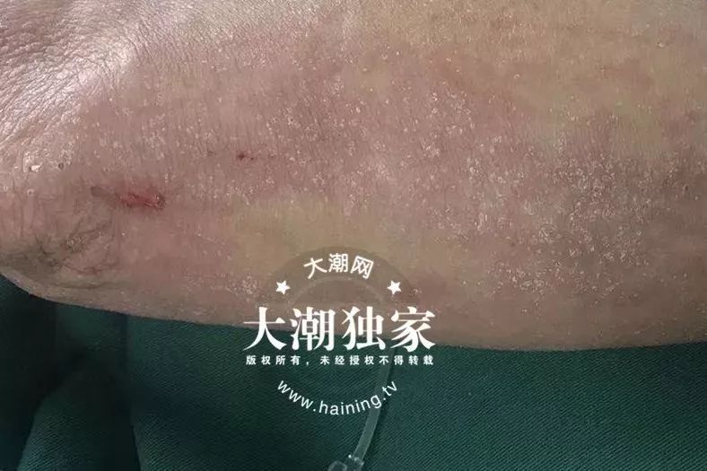 女子半夜惊醒发现有人站床边,女子半夜惊醒陌生男子站在眼前