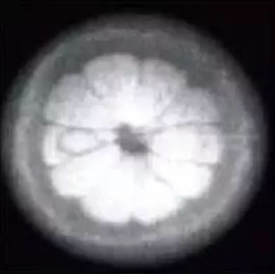 磁共振设备发展史,磁共振成像的发展历程