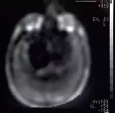 磁共振设备发展史,磁共振成像的发展历程