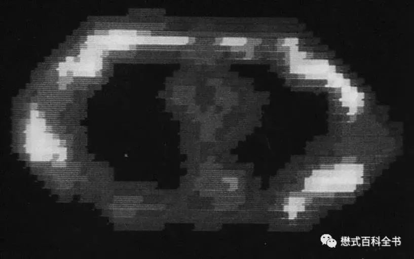 磁共振设备发展史,磁共振成像的发展历程