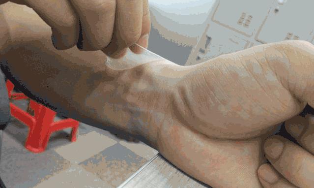 比创可贴好用,最好用的液体创可贴