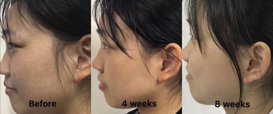 平价精华测评真实推荐,28天精华真实测评