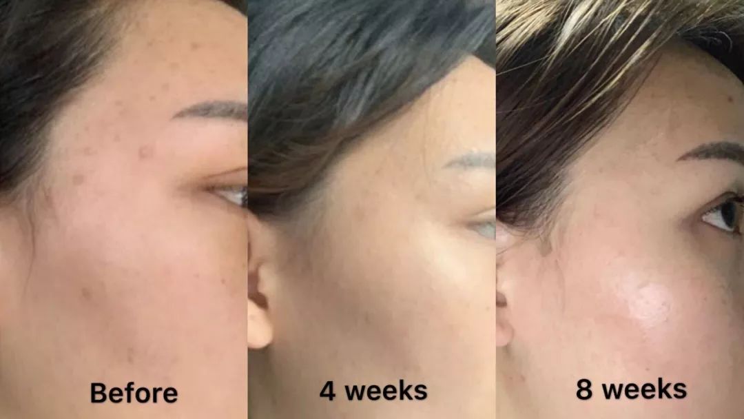 平价精华测评真实推荐,28天精华真实测评