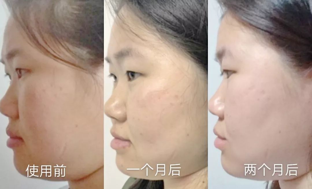 平价精华测评真实推荐,28天精华真实测评