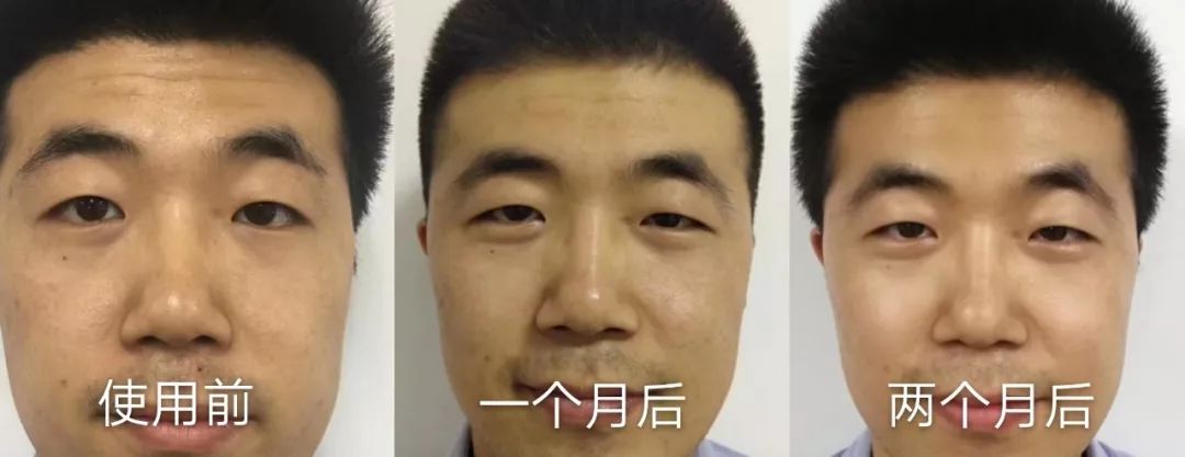 平价精华测评真实推荐,28天精华真实测评