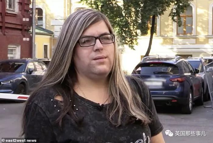 产后长络腮胡,女子生完孩子后长出满脸络腮胡