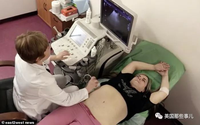 产后长络腮胡,女子生完孩子后长出满脸络腮胡