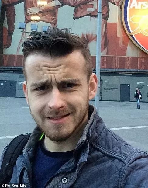 戴隐形眼镜感染的寄生虫,戴隐形眼镜眼睛里长虫子